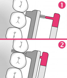 Kommer enkelt til mellom selv de innerste tennene